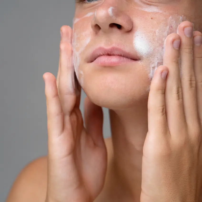 Acne Cleansing – 5 Tips to Keep in Mind Acne Cleansing – 5 Tips to Keep in Mind